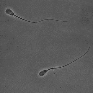 bull sperm semen