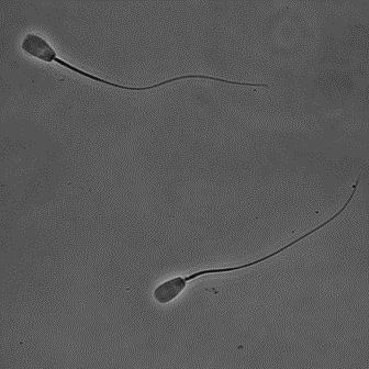 bull sperm semen