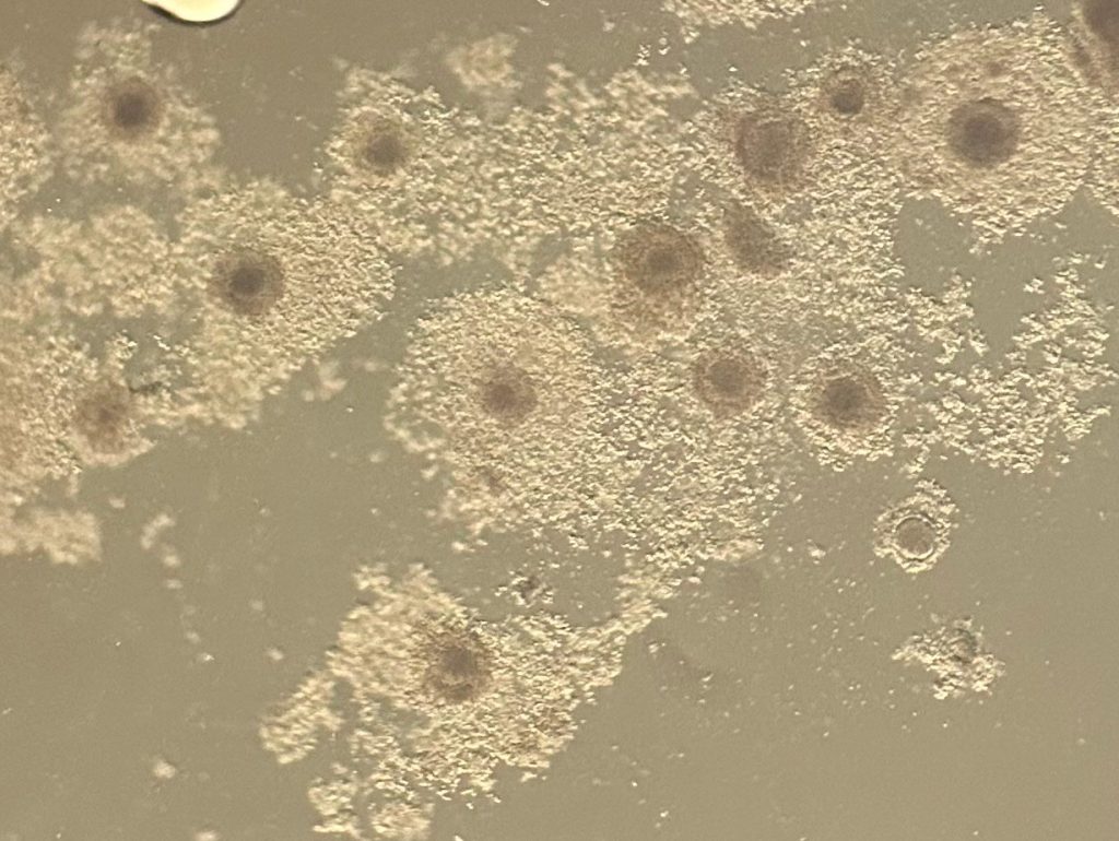 In Vitro Maturation Embryology Training ART Lab Solutions