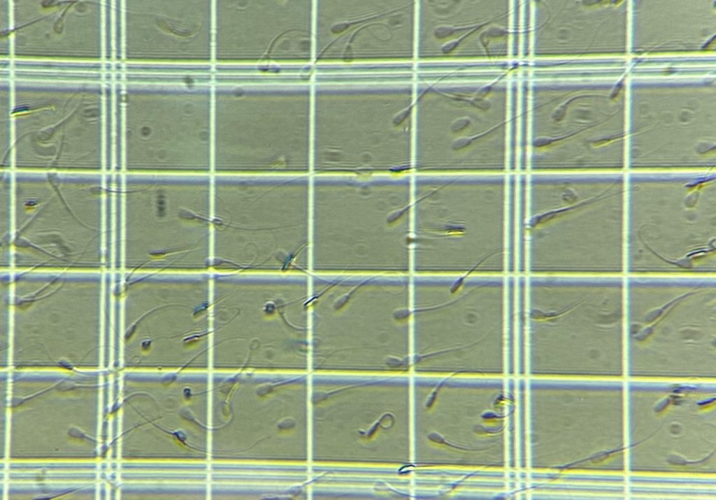 Counting Sperm Cattle Breeding Embryology Training In Vitro Fertilisation ART Lab Solutions